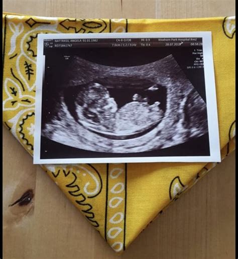 Anyone Want To Guess My Babys Gender From Scan Pic Mumsnet