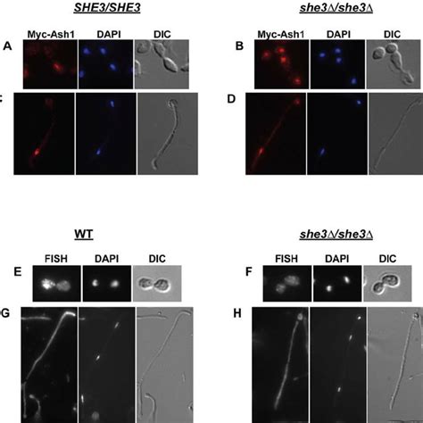 Yeast Hyphal And Pseudohyphal Morphologies A Budding Yeast Cells