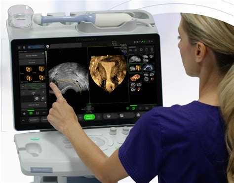 Ge Voluson Swift Ultrasound Video Overview