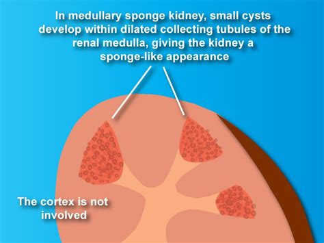 Medulla Of Kidney Function