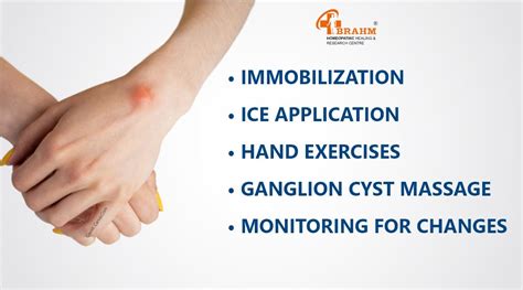 Ganglion Cyst Hand Ganglion Cyst Hand Best Treatment Ganglion Cyst