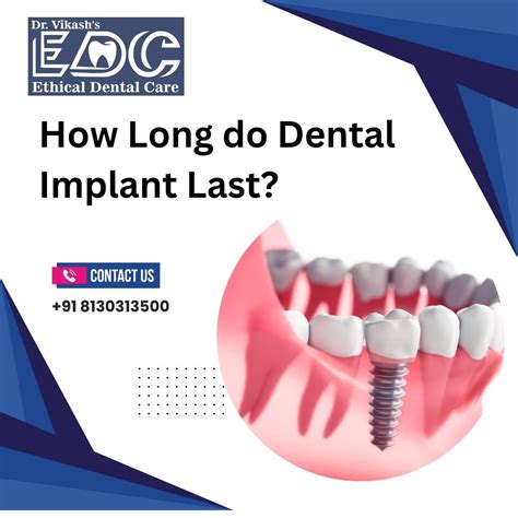 How Long Do Dental Implants Last