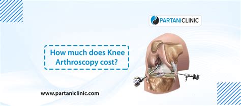 How Much Does Knee Arthroscopy Cost Dr Arun Partani