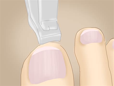 How To Treat A Sore Toe Steps With Pictures Wikihow