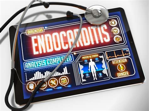 Endocarditis : Overview, Causes, Symptoms, Treatment - illness.com