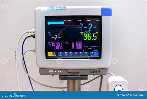 Electrocardiogram Monitor