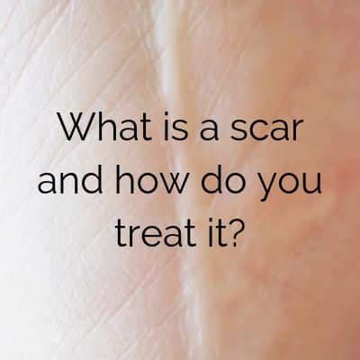 HOW TO GET RID OF SCARS FROM INGROWN HAIR - Brazilian Wax Regina