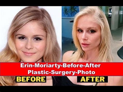 Erin Moriarty Before After Plastic Surgery Youtube