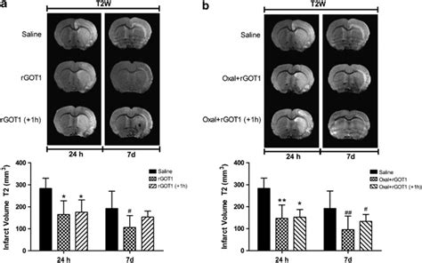 Infarct Size Assessed By Means Of Mri In Mcao Rats Mcao Rats Were