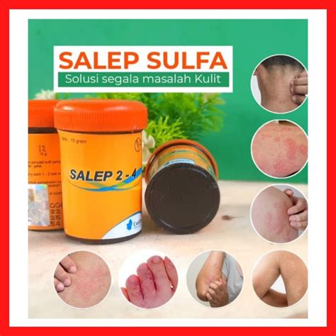 Jual Salep Zulfa Salep Belerang Sulfur Eksim Jerawat Kurap Jamur Kulit