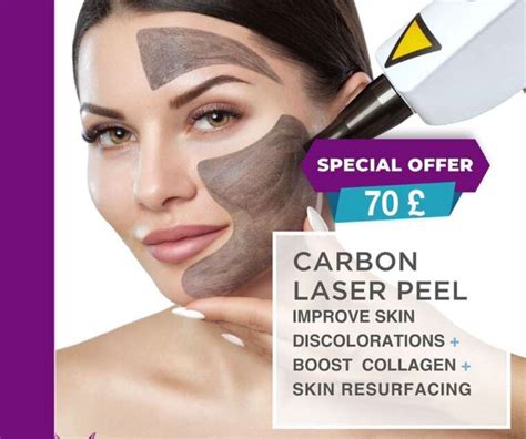 Carbon Facial Merit Wellbeing Center