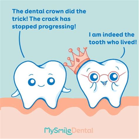 Cracked Tooth MySmile Dental Clinic