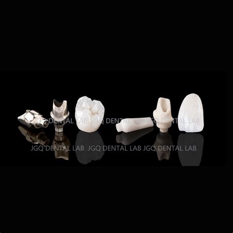 Denture Restoration Dental Abutment and Metal Bridges Digital Screwed ...