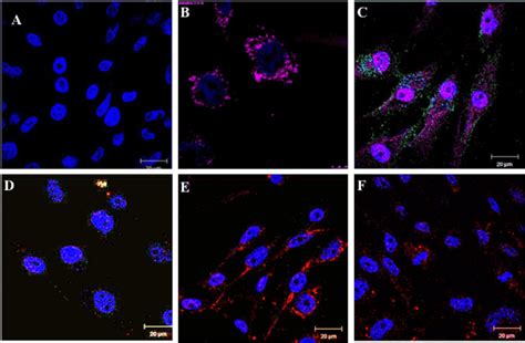 Immuno Fluorescence Assay Of Tgf Morphology After Different