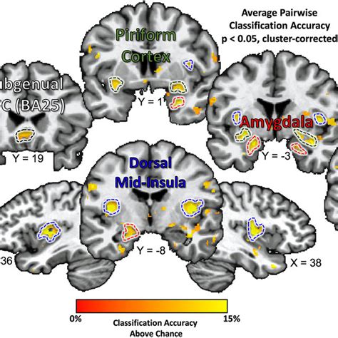 Multivariate Pattern Analyses Decode Taste Quality Within Brain Regions