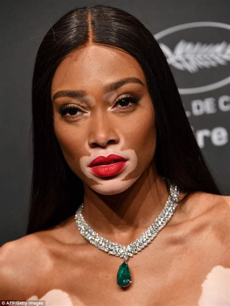 hello there.: Stunning vitiligo model, Winnie Harlow steals the ...