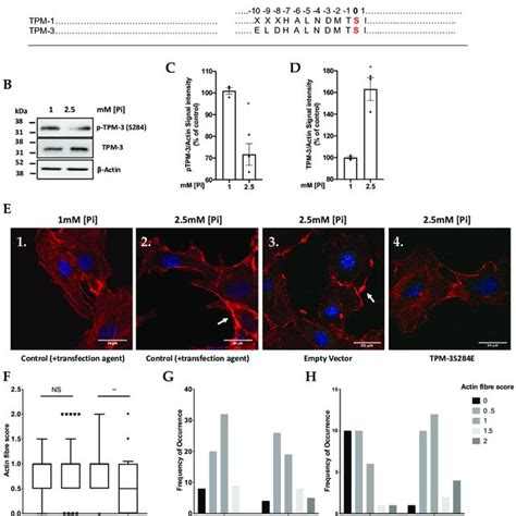 Diagram Of Proposed Pi Induced PP2A Src DAPK 1 TPM 3 Signaling Pathway