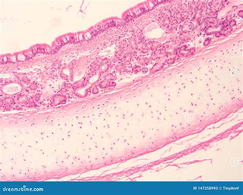 Histology of Trachea Human Tissue Stock Image - Image of show, biology ...