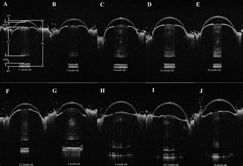 Shown Are Representative Examples Of Whole Eye Oct Images Recorded In