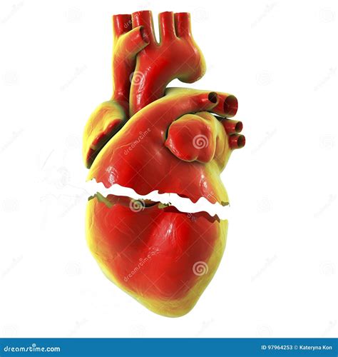 Realistic Broken Heart Separation And Divorce Concept Stock Illustration Illustration Of