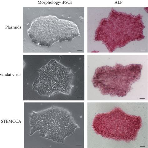 Generation And Characteristics Of HiPSCs Derived From Skin Fibroblasts