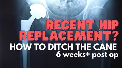 Hip Replacement Post Op 6 Weeks And Beyond Ditch The Cane Dr Alyssa