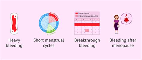 What Are The Symptoms Of Endometrial Hyperplasia