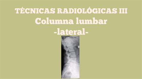 Proyecci N Lateral De Columna Lumbar Youtube