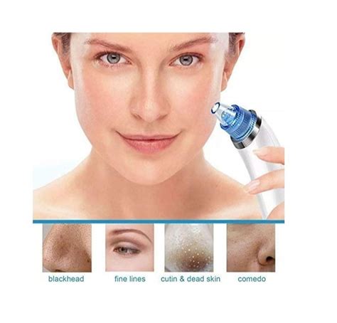 Abs Plastic White Derma Suction Blackhead Remover For Parlour Normal