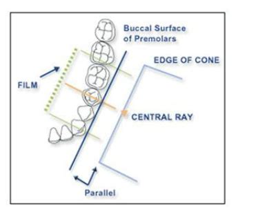 L Describe Intra Extra Oral And Digital Radiographic Techniques