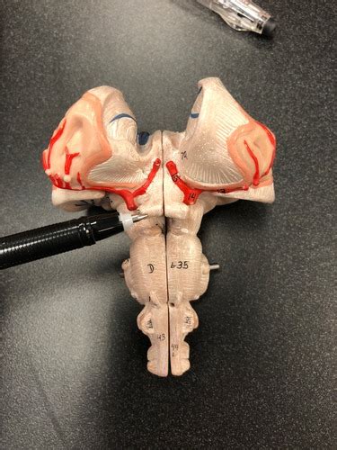 Brain Stem And Cerebellum Flashcards Quizlet