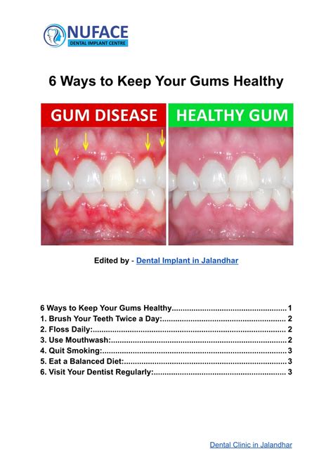 PPT 6 Ways To Keep Your Gums Healthy PowerPoint Presentation Free