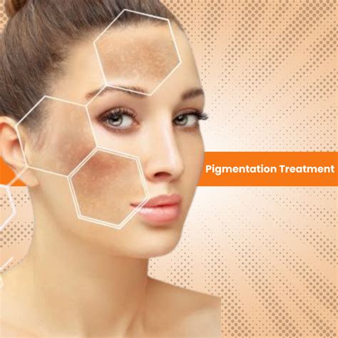 Pigmentation Treatment Kit Your Ultimate Guide To Flawless Skin