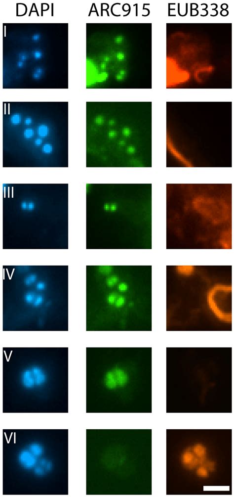 Fluorescence In Situ Hybridization Performed On A Human Skin Download Scientific Diagram