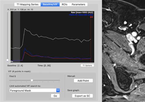 Can Quantitative Analysis Of Multi Parametric Mri Independently Predict