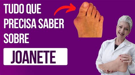 Joanete Saiba O Que Como Se Forma E Como Tratar Youtube