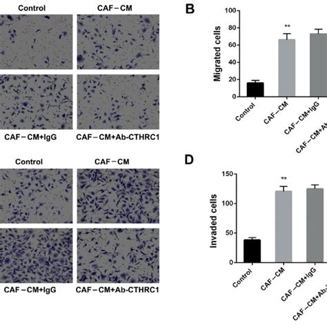 Cafs Enhance The Migration And Invasion Abilities Of Breast Cancer Download Scientific Diagram