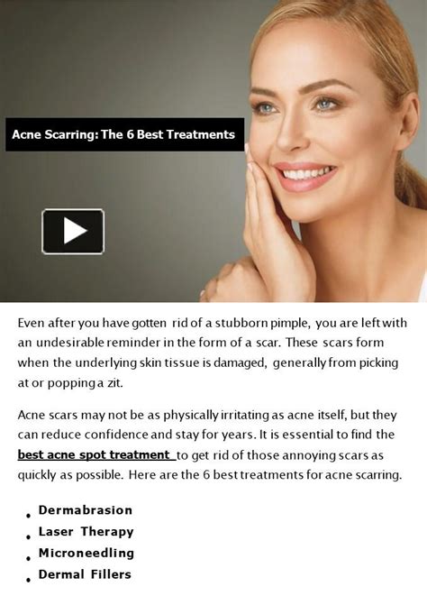 Ppt Acne Scarring The 6 Best Treatments Powerpoint Presentation Free To Download Id