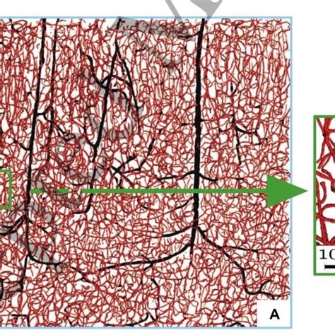 Human Brain Microvascular Architecture A In The Brain Intracortical