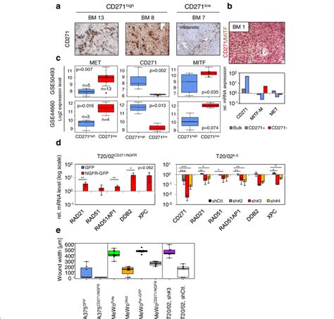 The Expression Of CD271 Determines Melanoma Cell Properties A