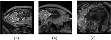 Figure 1 From Fully Automated Brain Extraction And Orientation In Raw