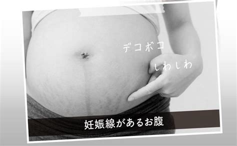 定番人気の妊娠線予防オイル・クリーム紹介と塗り方｜妊娠線予防は安定期に入るまでに始めよう うめこ、母になる