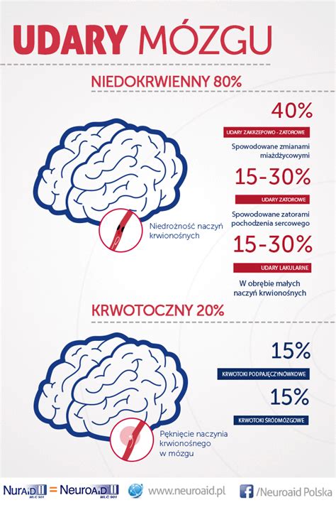 Rehabilitacja Po Udarze M Zgu Neuroaid