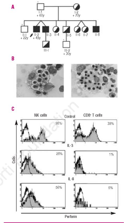 Figure From Familial Hemophagocytic Lymphohistiocytosis In An Adult