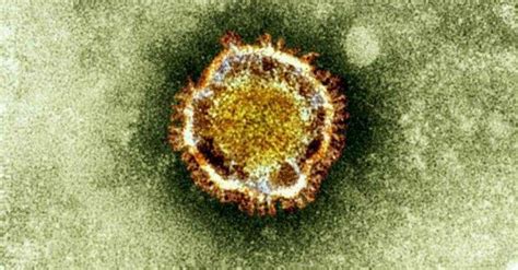 Pithovirus Sibericum Ecco Il Virus Gigante Che Viene Dalla Siberia