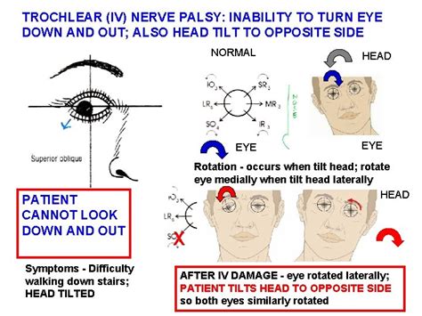 REVIEW OF HEAD AND NECK CRANIAL NERVES ETC