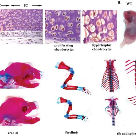 Chondrocyte Specific Deletion Of Jab In Mice Leads To Severe And