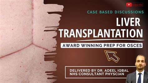 Liver Transplantation Abdominal Best Osce Preparation For Medical