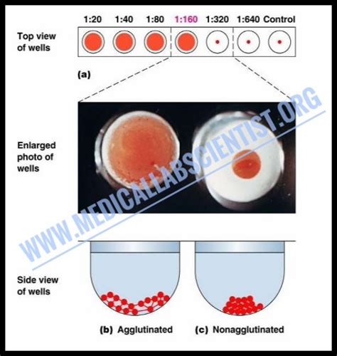 Rh Antibody Titre Test Purpose, Procedure, Result And More, 49% OFF