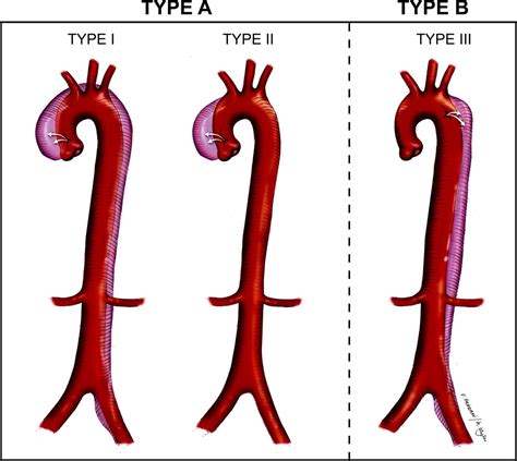 Ct Case Litfl Ct Scan Interpretation